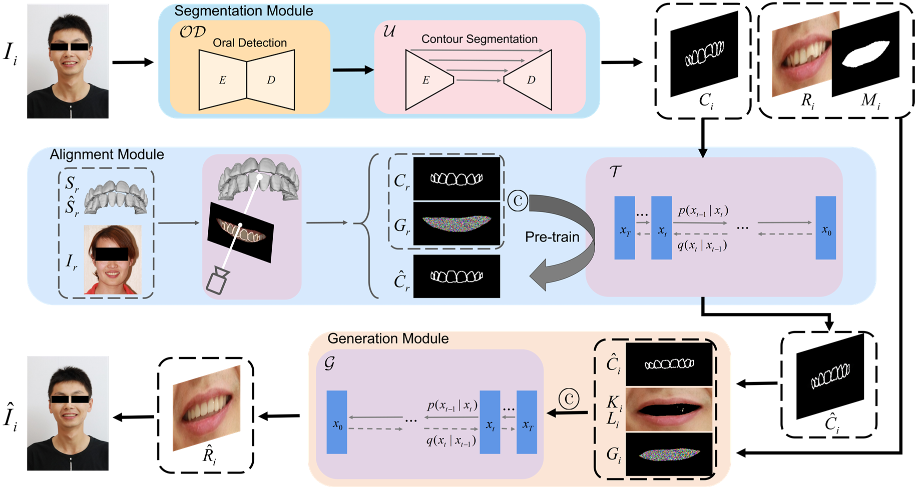 3D Structure-guided Network for Tooth Alignment in 2D Photograph